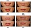 Best Lip Plumpers for 2015 - Lip Plumper Reviews - m