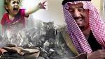 ضحايا العدوان السعودي على اليمن