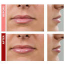 FAQ Fullips Lip Enhancers