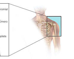 Imagem de Bursite subacromial no ombro