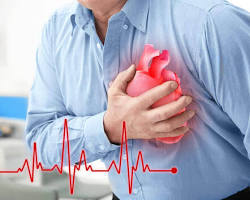 Gambar Penyakit jantung