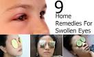 Causes, Treatment, and Home Remedies for Swollen Eyelids