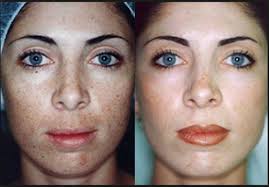 تصویر مرتبط