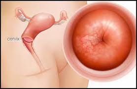 Image result for serviks