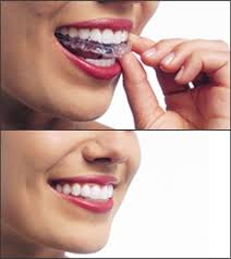 Denver orthodontist