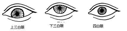 「三白眼、四白眼」の画像検索結果