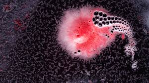 O bacterie comună în ochi ar putea provoca Alzheimer