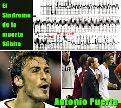 La trágica muerte del jugador del Sevilla FC Antonio Puerta ha puesto de nuevo de actualidad el debate sobre el síndrome de la muerte súbita en el deporte ... - antonio-puerta