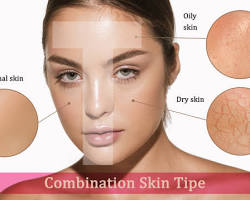 Image of Combination Skin
