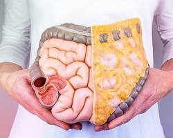 Hình ảnh về Hệ tiêu hóa thải độc