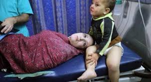 Image result for palestine children slaughtered