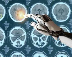 Imagen de AI analyzing medical scans