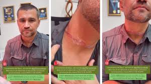 “Quase perdi meu marido”, diz vereadora após acidente com fio solto em Cuiabá