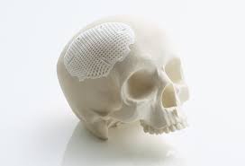 Changing the face of medical with Lithoz 3D printed ceramics
