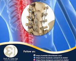 ستستغرق عملية التثبيت بضع دقائق