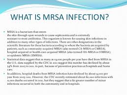 Image result for mrsa