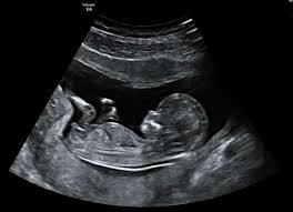 Hello everyone, I'm reaching out for help as my family and I ...