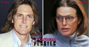 Whatever the reason behind Bruce Jenner&#39;s plastic surgery transformation, neither Brandon nor Brody Jenner are happy about it. In fact, both Jenner boys ... - bruce-jenner-plastic-surgery-transformation