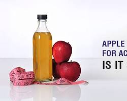 Apple cider vinegar for acid reflux