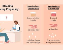 صورة light spotting during pregnancy