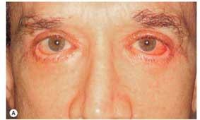 Related image