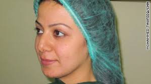 Noor Aziz wanted a nose job to fix a previous surgery. STORY HIGHLIGHTS. More Iraqis are electing to undergo cosmetic surgery - story.noor.b4.cnn