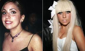 Resultado de imagem para antes e depois dos famosos