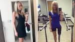  Woman hid her 'ugly' leg for 20 years — then got it chopped off