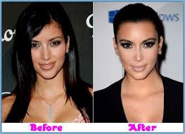 Résultat de recherche d'images pour "who is kim kardashian before and after"