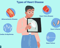 Heart disease