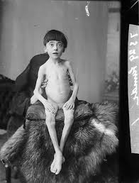 Résultat de recherche d'images pour "children starving"