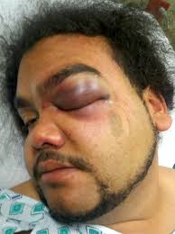 Jose Lugo Not Guilty of Assaulting Rochester, NY Police Officer. Juror: “The Police officers Were Overzealous.” October 3, 2012 | 27 Comments - Lugo-71