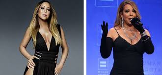 Resultado de imagem para antes e depois dos famosos