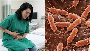 ¿Cuáles son las señales de alerta de la Salmonella? Síntomas que causa la bacteria tras brote infeccioso en Ho