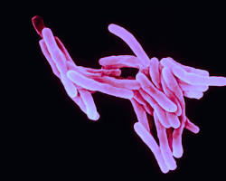 Image of tuberculosis microscopic images