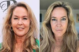 Erin Murphy Shuts Down Facelift Rumors