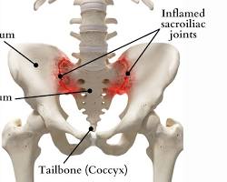 Sacrum bone