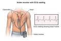 Cardiac Event and Holter Monitoring - LifeWatch