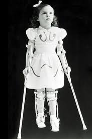 Polio in the 1950s