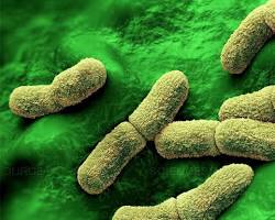 Image of Yersinia pestis bacteria