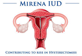 Image result for IUD image