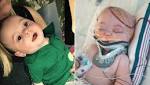  Mom Speaks Out After Infant Suffers Brain Damage From Falling Off Bed: 'He's Not the Same'