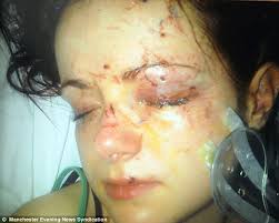 Thug who did THIS to woman after throwing a pint glass in her face could walk ... - article-0-1B6C1415000005DC-784_634x507