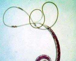 Image of Trichuris worm