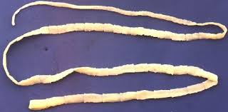 Image result for platyhelminthes