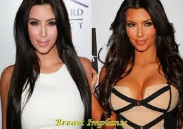Résultat de recherche d'images pour "who is kim kardashian before and after"