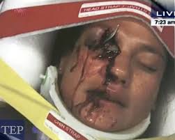 Image result for takata recall