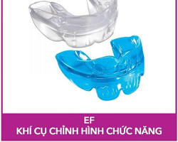 Image of Khí cụ chỉnh nha chức năng