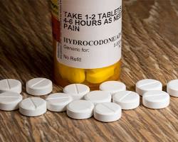 Hydrocodone