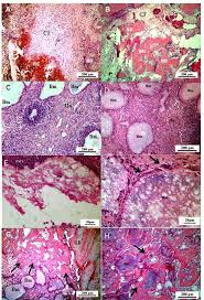 Image result for β-TCP, β-TCMP